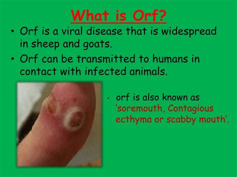 fakboi.orf|orf disease.